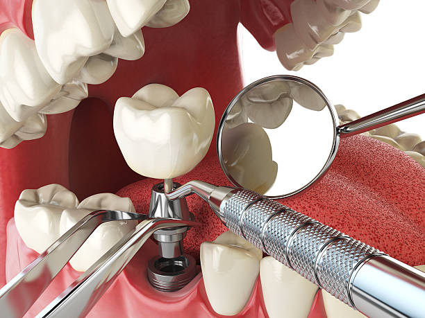 Best Emergency Treatment for Jaw Pain or Injury in Belle Plaine, KS